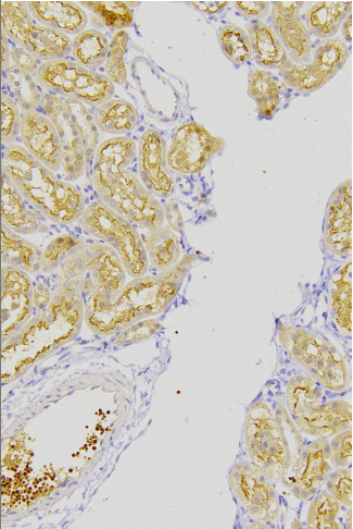 ScreenShot_2026-03-20_213210_821